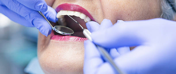 Best Emergency Dental Services for Seniors in Lake Lakengren, OH